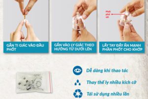 Minh họa cách thay thế ly giác hơi duy thành