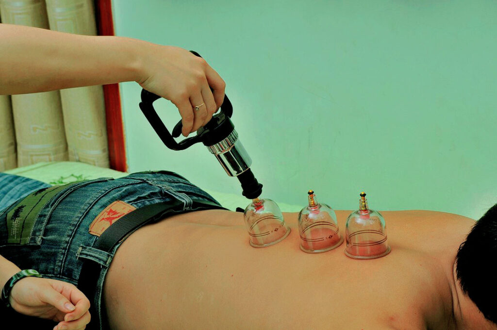 Bộ giác hơi không dùng lửa Duy Thành chính hãng