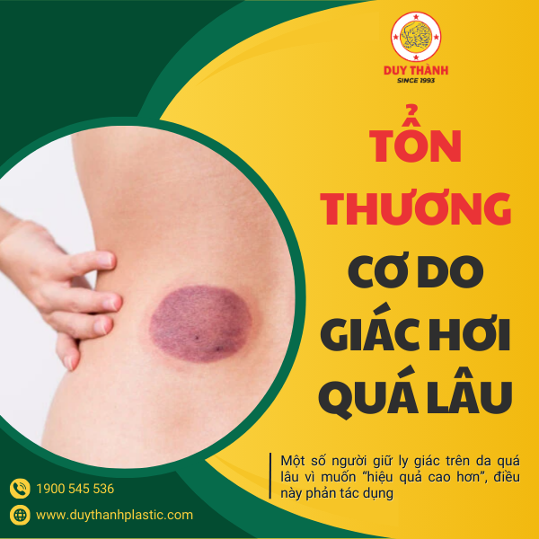 Da và cơ bị tổn thương do để ly giác quá lâu